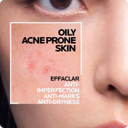 /eg-lrp-effaclar-h