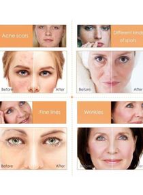 ardor vitamin c serum